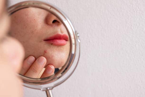Skin Barrier Adalah: Choosing the Secrets to Healthy Skin
